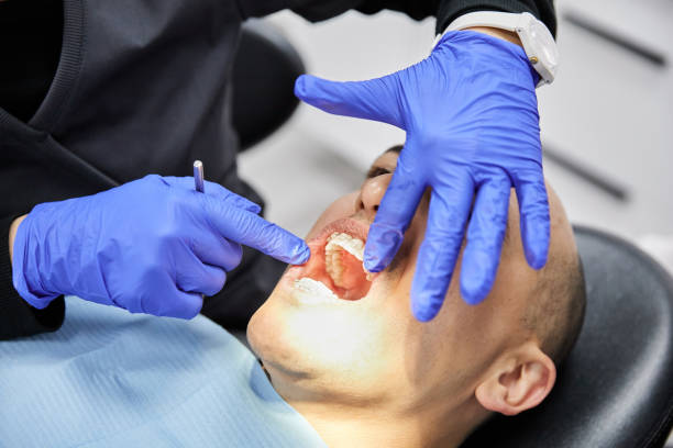 Best Emergency Treatment for Dental Infections or Abscesses in Rangely, CO